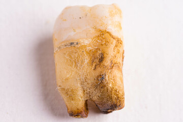 extracted dirty white tooth with root