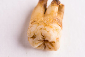 extracted dirty white tooth with root