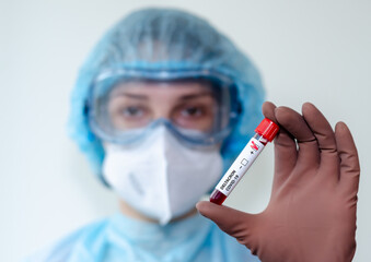 Medical laboratory assistant holding test tube with positive Deltacron COVID-19 test blood sample.