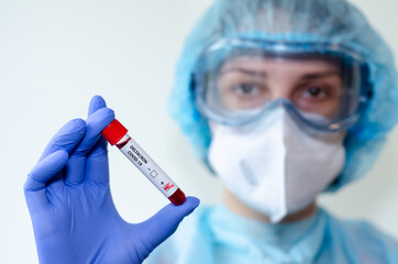 Medical laboratory assistant holding test tube with positive Deltacron COVID-19 test blood sample.