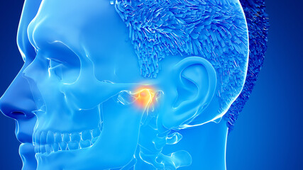 3d rendered illustration of a painful temporomandibular joint - obrazy, fototapety, plakaty