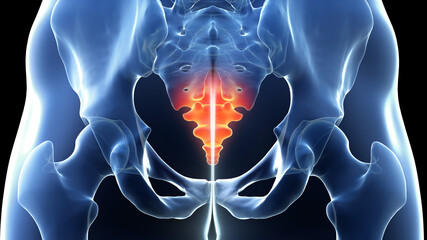 3d rendered illustration of a painful coccyx - obrazy, fototapety, plakaty