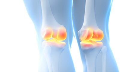 3d rendered illustration of painful knee joints