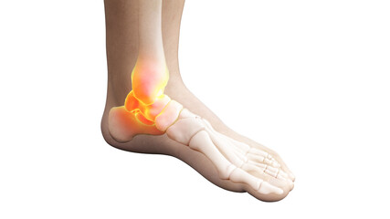 3d rendered illustration of a painful ankle joint - obrazy, fototapety, plakaty