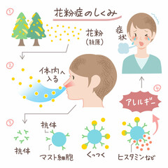 花粉症のしくみのイラスト 説明図 図表 アレルギー