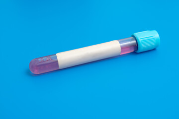 Test tube with empty label  to biological sample for medical laboratory research on blue background