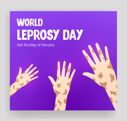 Obraz premium World Leprosy Day is observed on the last Sunday of January every year. World Leprosy Day Symbol for Social Media Template Banner, Cover, Story, Post. 