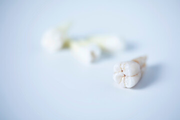 Close-up view of wisdom tooth and a blur back ground of some extracted teeth.