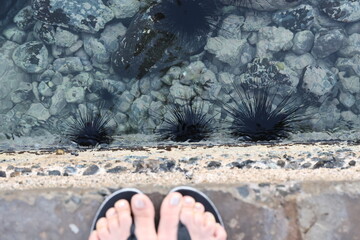 wild sea urchins 