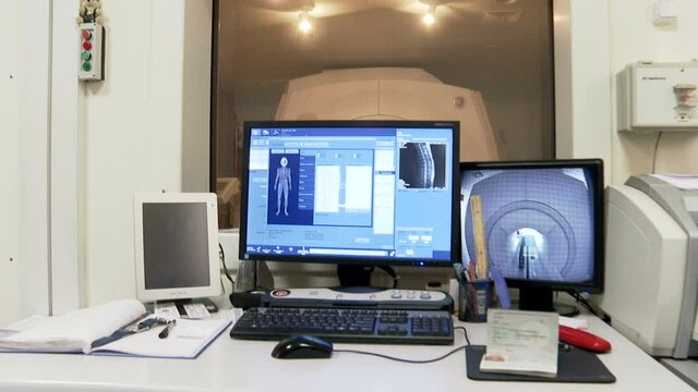 MRI scan screen animation. Computed medical tomography MRI. Diagnosis medical data