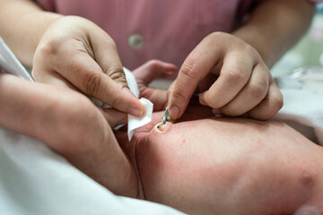 A nurse is cleaning the umbilical cord of newborn baby. Health care and medical action photo. Close-up and selective focus. - obrazy, fototapety, plakaty