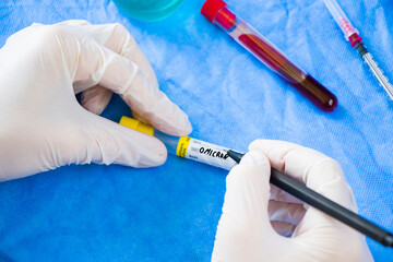 Omicron blood test. Doctor in laboratory with uniform write text on the blood tube sample