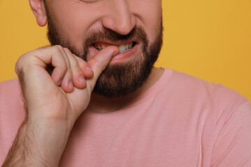 Obraz premium Man biting his nails on yellow background, closeup. Bad habit