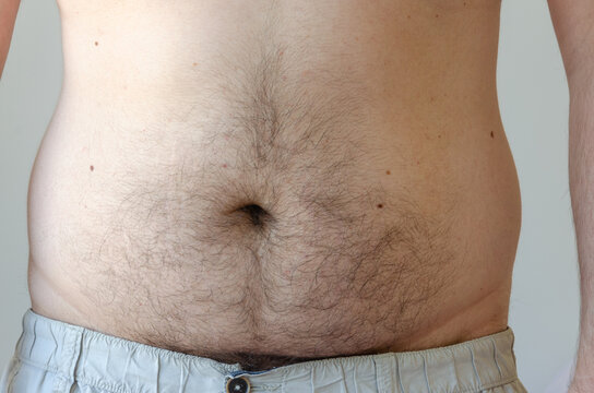 Closeup On A Fat Man Belly Shirtless