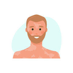 happy man with vitiligo. blond person with dipigmentation. The guy suffers from genetic and immune problems with the skin of his face and body. Vector illustration, flat