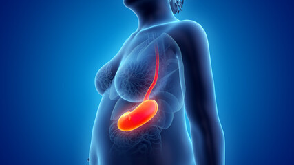 3d rendered illustration of an obese womans stomach