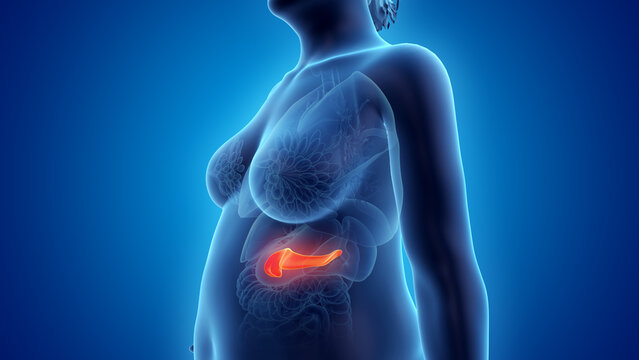 3d rendered illustration of an obese womans pancreas