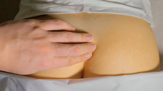 Fracture of the coccyx of spine. External medical exam by a doctor. Gloved hands show trauma. The sacrum and coccyx protrude and are clearly visible.