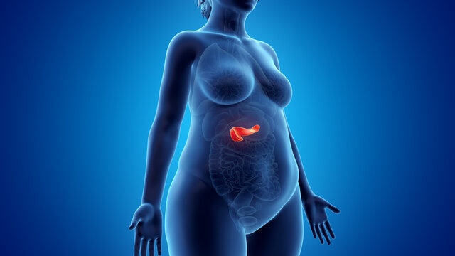 3d rendered illustration of an obese womans pancreas