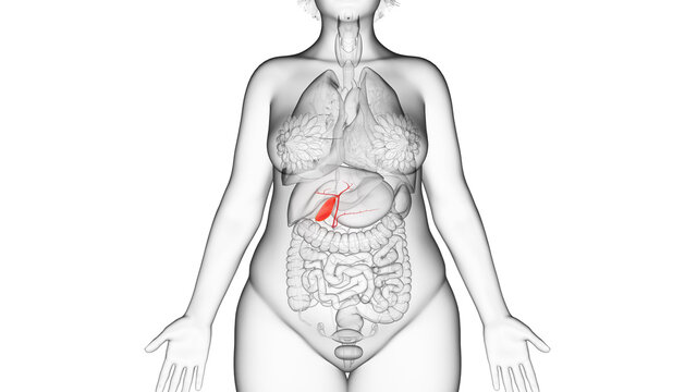 3d rendered illustration of an obese womans gallbladder