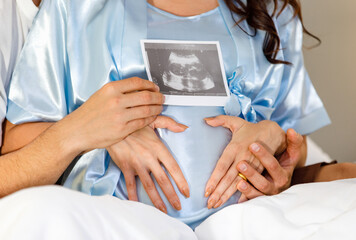 Cheerful Caucasian husband tenderly embrace lovely pregnant wife on bed under quilt and smile to show x-ray film image of expecting unborn baby