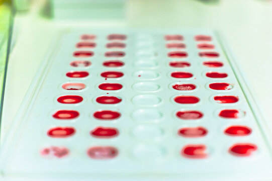 blood plastic palette in the process of determining blood group, RH and Kell group. the focus is on the center of the picture, the edges are slightly blurred. medical laboratory 