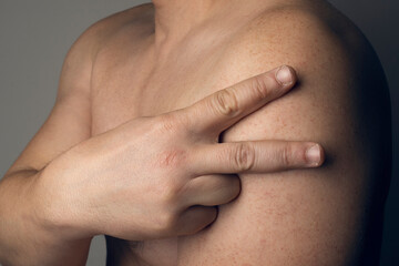 Man makes a V with his fingers on his arm to indicate that he is vaccinated