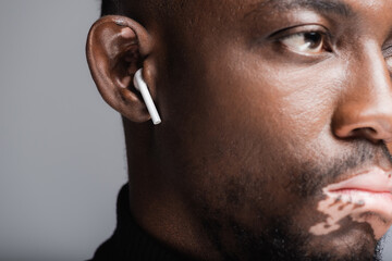 close up view of cropped african american man with vitiligo listening music in earphone isolated on grey.