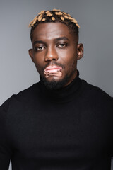 african american man with vitiligo skin and trendy hairstyle looking at camera isolated on grey.