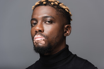 Fototapeta premium portrait of african american man with vitiligo skin and stylish hairstyle looking at camera isolated on grey.