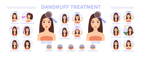 Woman with Dandruff on Head. Dandruff Treatment. Recommendations. Steps. Before and After. Symptoms. Happy Girl with Healthy skin. Set. Cartoon style. Vector illustration for Medical and Beauty Design