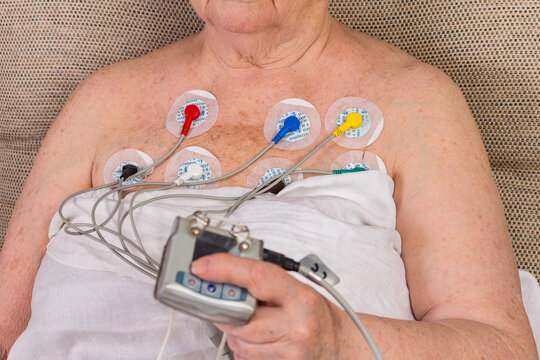 Disposable electrodes on an senior woman. Medical electrodes Round Pads and sticker on patient. Selective focus