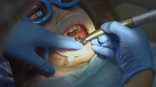 little girl with oral dilator at dentist's appointment. polishing of teeth