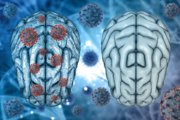 Fototapeta 3D medical background of healthy brain and diseased brain with Covid 19 virus cells obraz