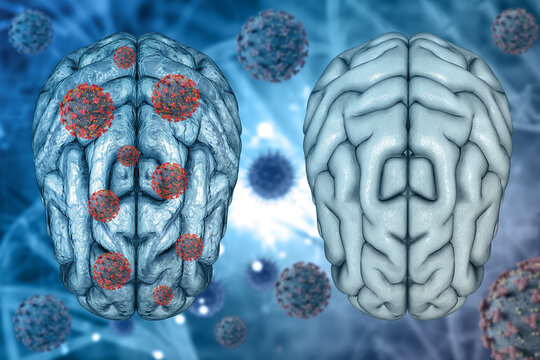 3D medical background of healthy brain and diseased brain with Covid 19 virus cells