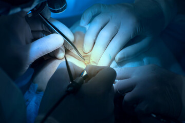 surgical operation, in the surgeon's hand close-up tweezers.