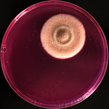 colonia de un hongo aislada en el laboratorio de microbiolog&iacute;a, o laboratorio cl&iacute;nico