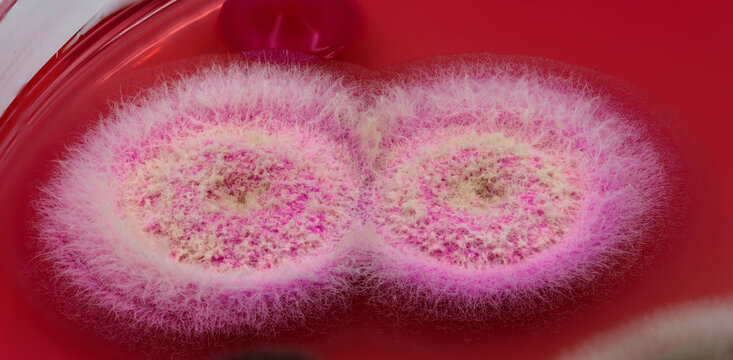 Colonias filamentosas de hongos sobre el medio de cultivo Rosa de Bengala Cloranfenicol Agar