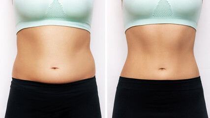 Two shots of a woman's belly with excess fat and toned slim stomach with abs before and after...