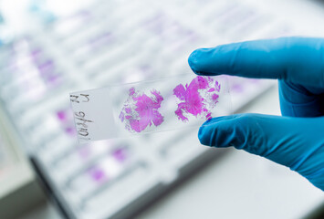 Hand in blue glove holding glass histology slides