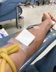 Vertical picture and close up view. The arm of person who is in process of transferring blood into storage container. Which is the blood donation of people on important day of the year.