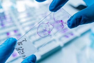 Hand in blue glove holding glass histology slides