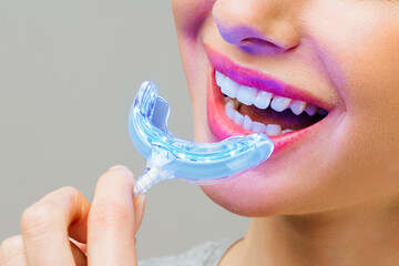 A young woman is engaged in home teeth whitening. Complex for teeth whitening with UV lamp