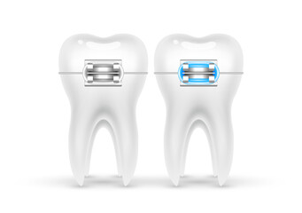 Orthodontic treatment style fashion beautiful blue. White teeth with metal brackets. Tooth braces isolated on a white background. Realistic 3D vector. Dental care health concept.