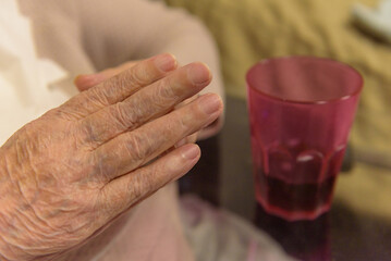 Parkinson's disease. An elderly person's hand during breakfast