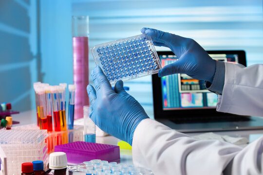 Researcher in lab holding a 96 well plate with biological samples for analysis. Scientist working in laboratory with samples in micro plate