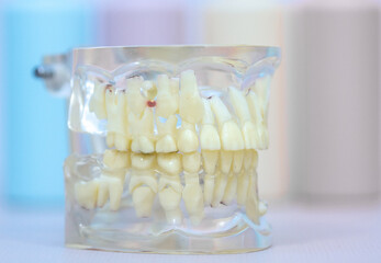 Silicone transparent model of the human jaw, side view, right side of the teeth.
