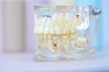 Silicone transparent model of the human jaw, side view, left side of the teeth.
