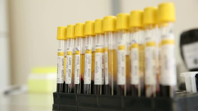 Professional laboratory workers pouring blood samples into vials on the table. Medical laboratory technicians making blood experiments in research clinic