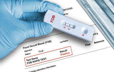 Positive FOB rapid test result by using rapid testing cassette to detect hidden blood in feces